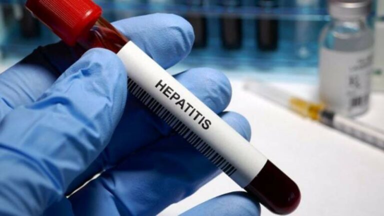 brote de hepatitis en ninos cuales son los sintomas de la enfermedad y como puedes infectarte 768x432 1